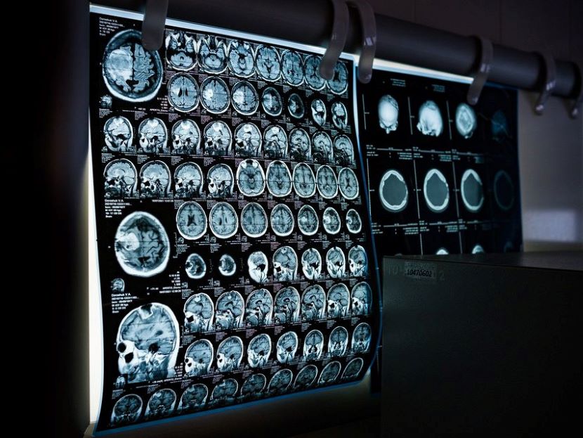 Medizinisch-technische Radiologie Assistentin