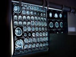Medizinisch-technische Radiologie Assistentin